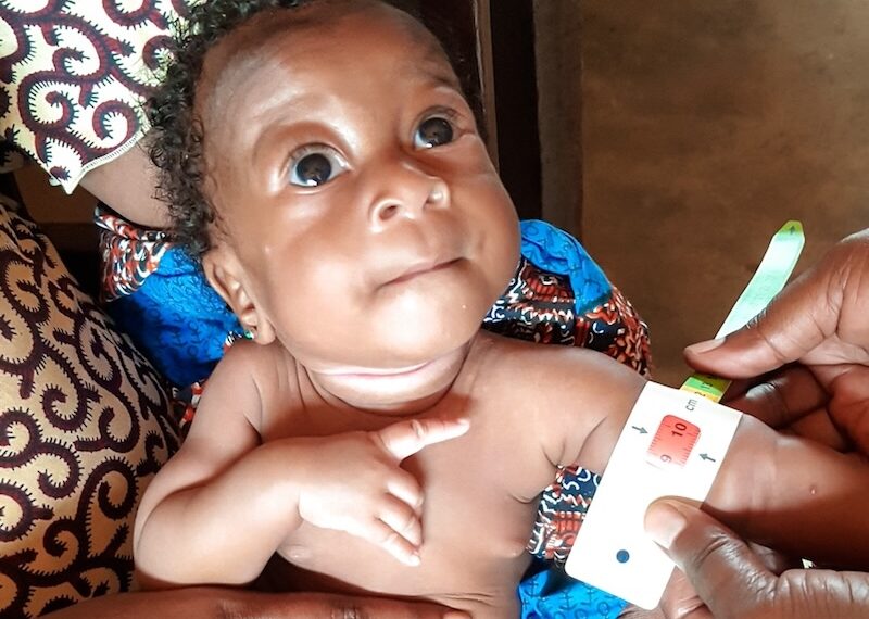 Comment reconnaître la dénutrition chez un enfant